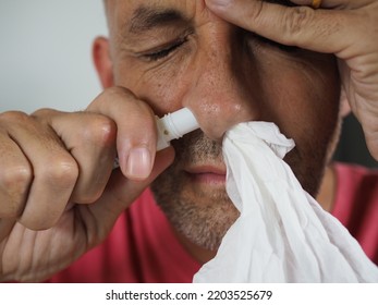 Man With A Cold Has His Head In His Hand And Tissue Stuck Up One Nostril With Menthol Inhaler In Nose.