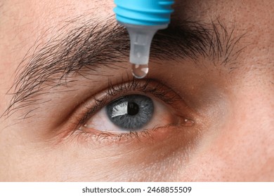 Man with conjunctivitis using eye drops, closeup