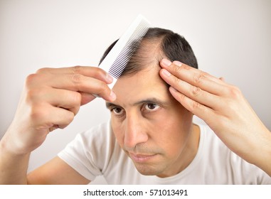 Man Controls Hair Loss With A Comb