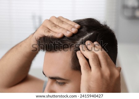 Man with dandruff in his dark hair on blurred background, closeup Foto stock © 