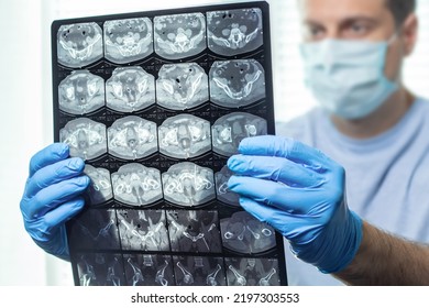 Man Doctor In Mask Examines  MRI In Hospital.