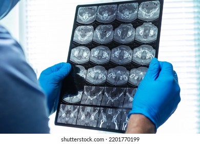 Man Doctor In Mask Examines  MRI In Hospital.