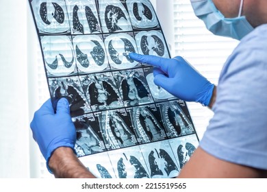 Man Doctor In Mask Examines MRI In Hospital.