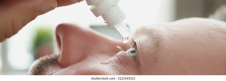 Man Dripping Antibacterial Drops Into His Eye Closeup. Dry Eye Treatment Concept