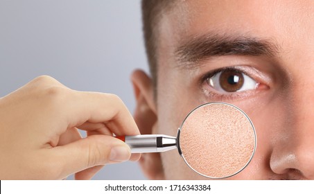 Man With Dry Skin Visiting Dermatologist, Closeup