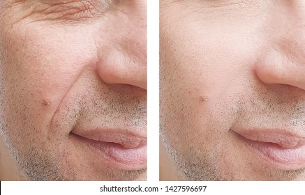 Man Wrinkled Face Images Stock Photos Vectors Shutterstock