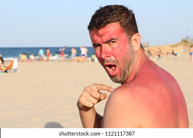 Man Getting Sunburned At The Beach