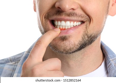 Man with gum inflammation on white background, closeup