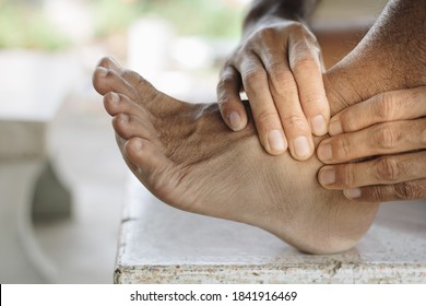 Man Had A Sore Ankle,Healthcare Concept