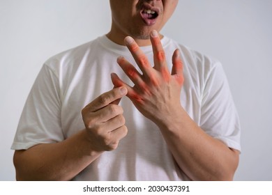 Man hand suffering from joint pain with gout in finger. Cause of pain include rheumatoid arthritis, carpal tunnel syndrome, trigger finger or gout. Health care and medical concept.