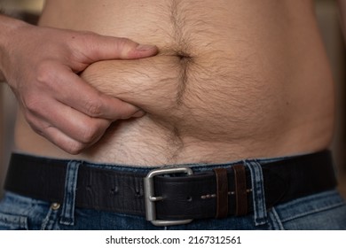 Man hand touches big creases on plump belly with appendicitis scar above jeans extreme closeup. Man concerns about overweight. Male bare belly