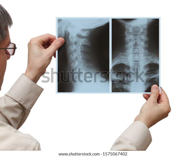 Man Hands Hold Xray Picture Frame Stock Photo Edit Now 1575067402