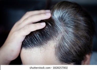 Dandruff Problem Images Stock Photos Vectors Shutterstock