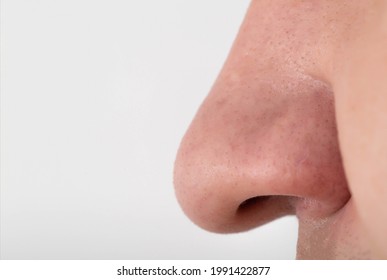 Picture of a big nose