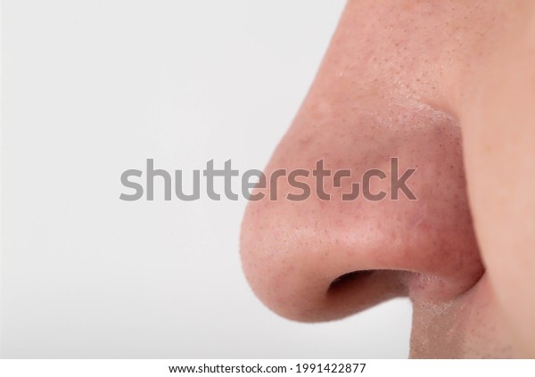 Man Has Wide Fleshy Big Nose Stock Photo (Edit Now) 1991422877.