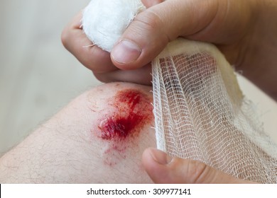 Man Heals  Wound On His Knee At Home. Holding Bandage At Hands 