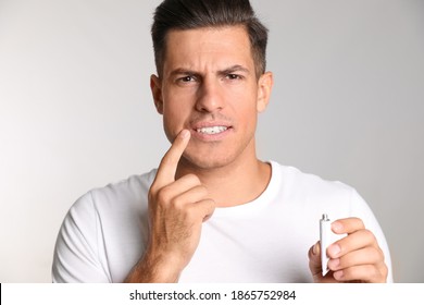 Man With Herpes Applying Cream On Lips Against Light Grey Background