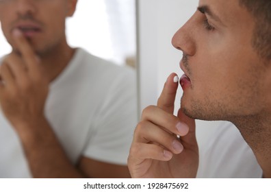 Man With Herpes Applying Cream On Lips In Front Of Mirror, Closeup