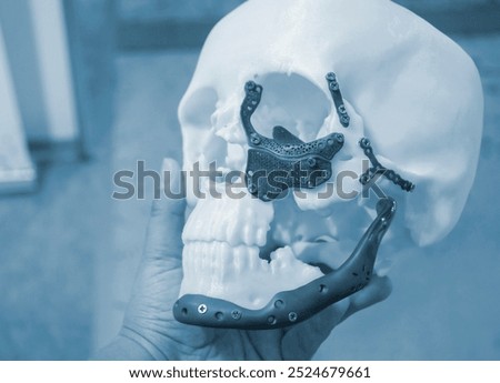 Man holding in hand proto-human skull from white plastic with titanium implants in form of plates and surgical templates printed on 3D printer. Biointegrated prosthesis