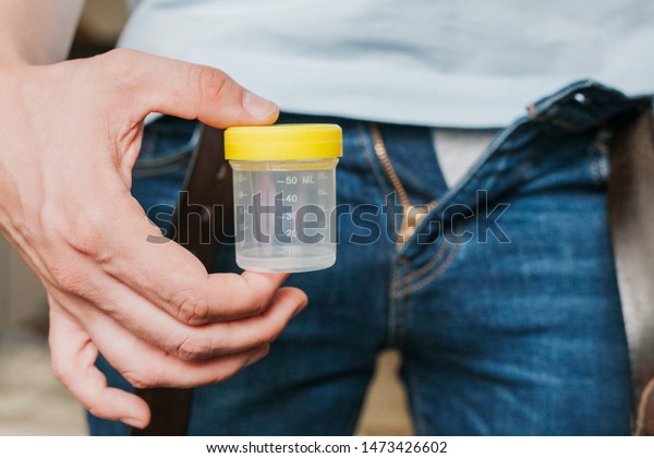 Man Holding In Hands Container With Sperm Sperm Donor Health