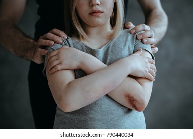 Man holding hands on little girl's shoulders standing with closed arms with wound on her elbow