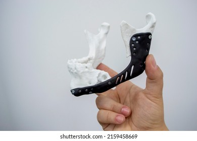 Man holding implantation of endoprosthesis of lower jaw. Model of lower jaw printed on 3D printer white plastic. Endoprosthesis printed on 3D printer for metal biocompatible titanium alloy black color - Shutterstock ID 2159458669