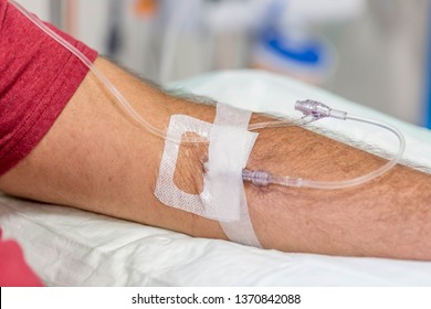 Man In Hospital Getting An Immunoglobulin Infusion With Intravenous Drip