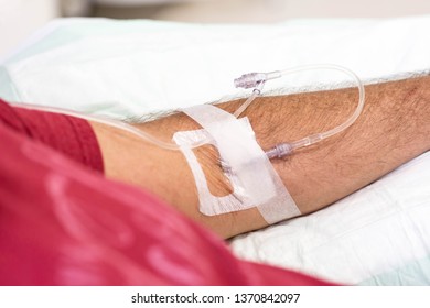 Man In Hospital Getting An Immunoglobulin Infusion With Intravenous Drip