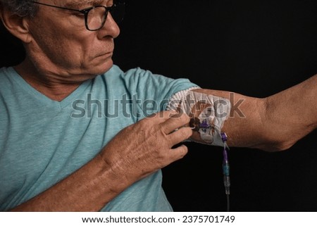 A man inspects the PICC line inserted in his upper arm