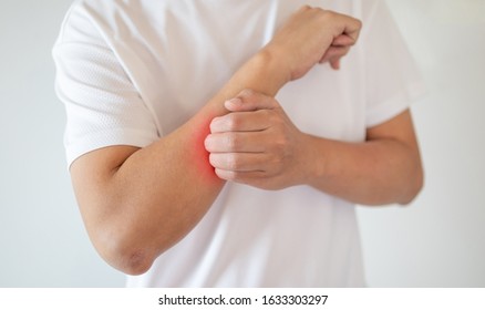 Man Itching And Scratching On Arm From Itchy Dry Skin Eczema Dermatitis