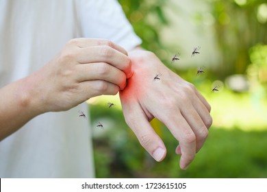 Man Itching And Scratching On Hand From Allergy Skin Rash Cause By Mosquitoes Bite