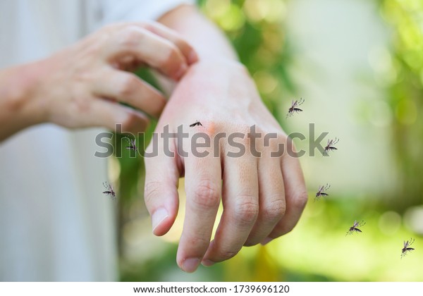 Man itching and scratching on hand from\
allergy skin rash cause by Mosquitoes\
bite
