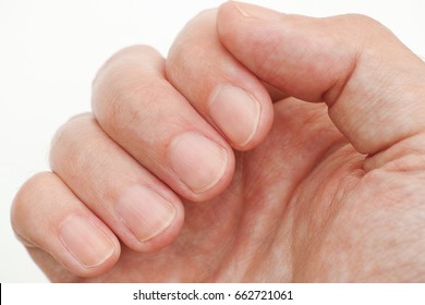 Man Looking At His Finger Nails. Close Up.