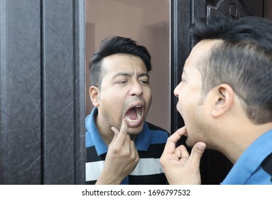 A Man Looking At His Reflection In Mirror With Open Mouth And Checking His Teeth For Cavity Infection And Toothache