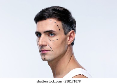 Man Marked With Lines For Plastic Surgery Looking Away