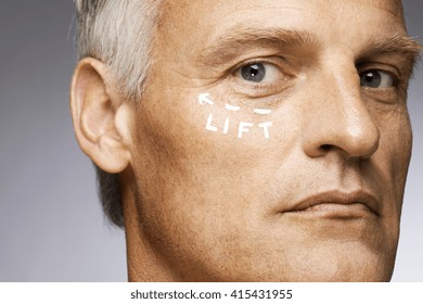 Man Marked With Lines For Plastic Surgery