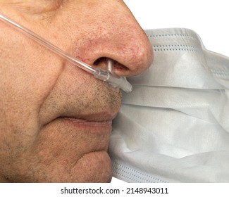 Man With Nasal Cannula In Nose Puts On A Medical Mask On His Face. Close-up.