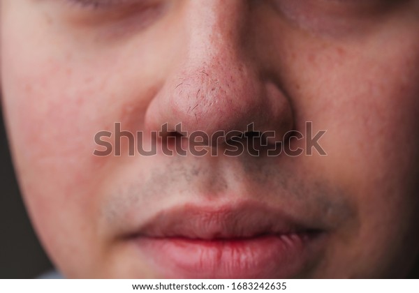 鼻毛の接写 毛は鼻の表面に生える 顔の毛の生え具合が増した 毛むくじゃらの多肉質の鼻の接写 の写真素材 今すぐ編集