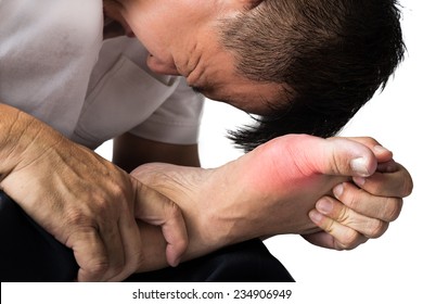 Man with painful and inflamed gout on his foot around the big toe area.