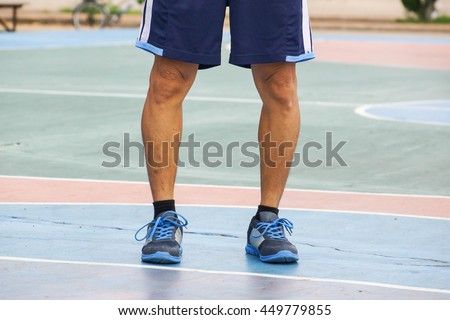 A man with physiological bow legs