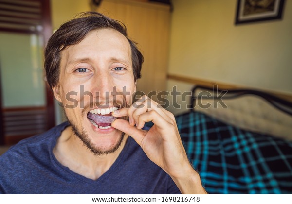Man placing a bite plate in his mouth to\
protect his teeth at night from grinding caused by bruxism, close\
up view of his hand and the\
appliance