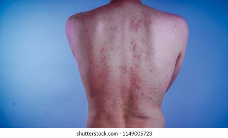 Dermatologisch Images, Stock Photos & Vectors | Shutterstock