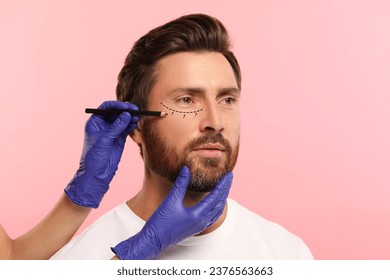 Man preparing for cosmetic surgery, pink background. Doctor drawing markings on his face, closeup - Powered by Shutterstock