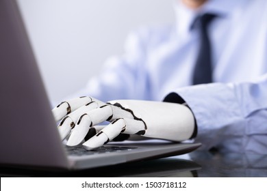 Man With Prosthetic Hand Working On Laptop. Artificial Limb