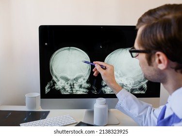 Man radiologist analyzing a child skull x ray with left parietal bone fracture. Child abuse  - Shutterstock ID 2138323925