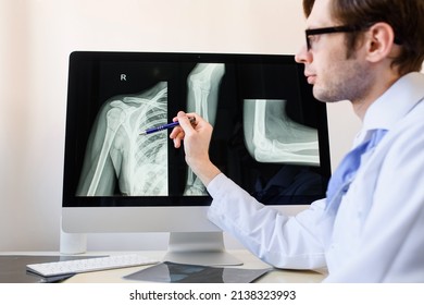 Man radiologist analyzing a patient arm and forearm bones x ray with a humerus fracture.