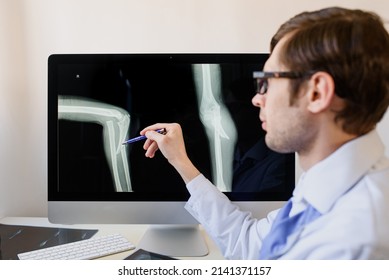 Man Radiologist Analyzing A Patient Child Elbow Bones X Ray With An Ulnar Fracture And Radial Luxation.