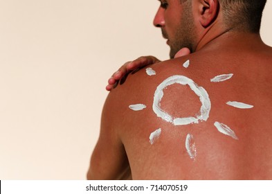 Man With Reddened, Itchy Skin After Sunburn. Skin Care And Protection From The Sun's Ultraviolet Rays. Cream Protection