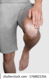 
Man Rubs Sore Knee With Anti-inflammatory Ointment, Close-up, Medical, Copy Space