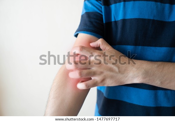 Man scratching arm from having itching  with redness\
rash over white background. Cause of itchy skin include dermatitis,\
eczema, psoriasis or fungal infection. Health care concept. Close\
up.